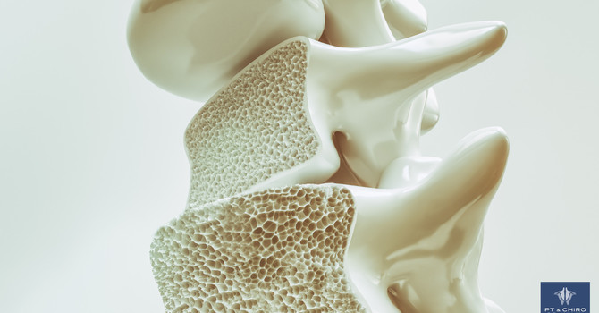 Is Chiropractic Safe with Osteoporosis? image