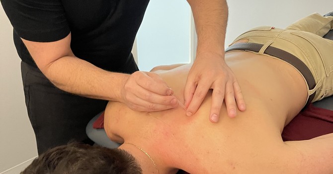 How does Dry Needling help with Injury Recovery?