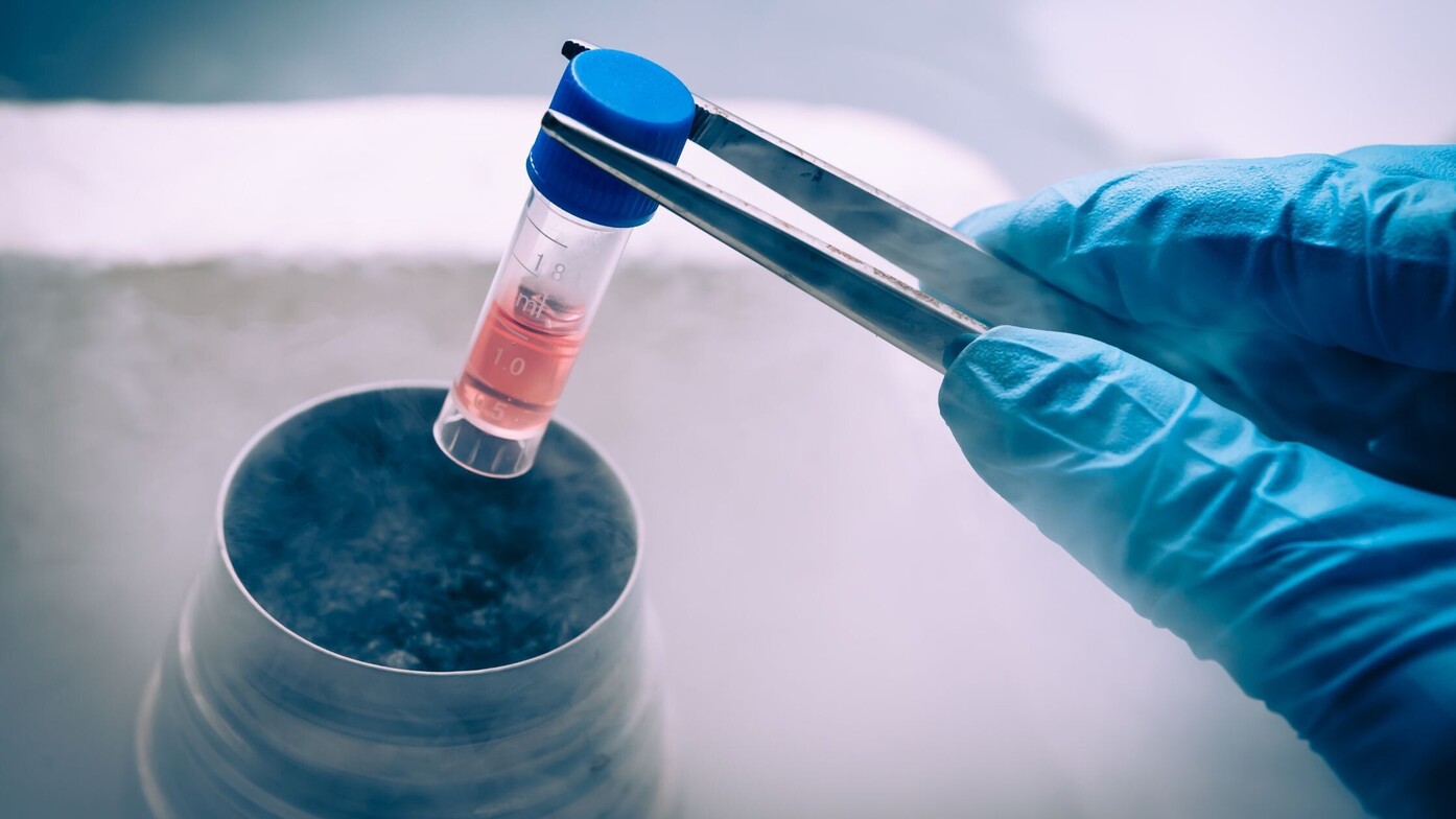 Autologous Stem Cells