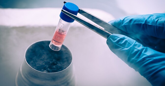 What Are Autologous Stem Cells and Why Does It Matter That They Come From Your Own Body? image