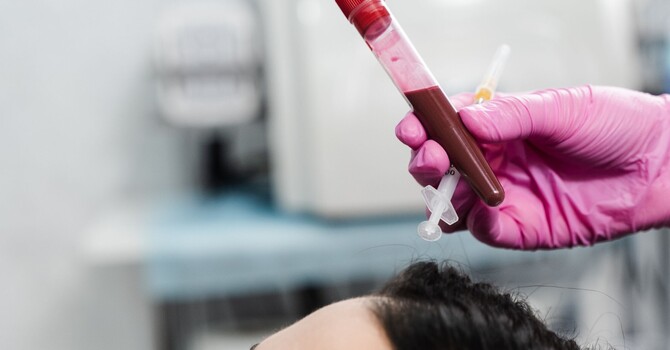 High Density PRP vs. Standard PRP