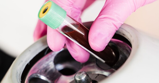 Combining Autologous Stem Cells With High Density PRP image