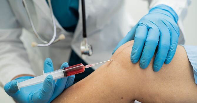 How Many High Density PRP Sessions Do You Actually Need?