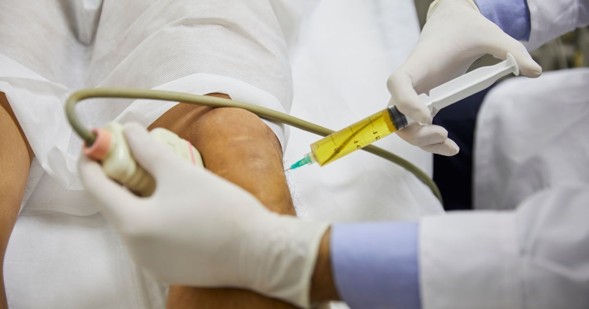 Stem Cell Therapy