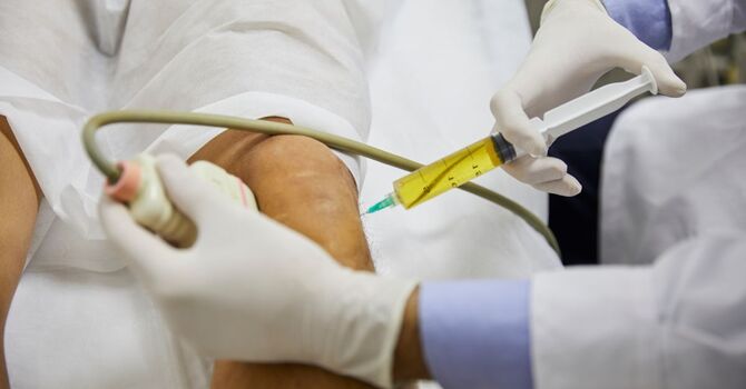 Stem Cell Therapy in Miami