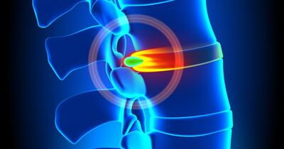 Improve Disc Pain